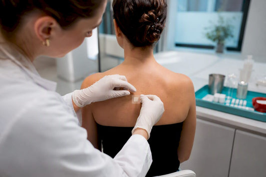 Clinician applying patch test for toothpaste allergy
